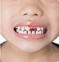 Dịch vụ nha khoa trẻ em